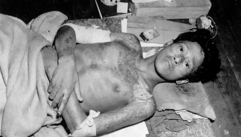 80 Yıl Sonra Nagasaki'den Gelen Uyarı: Nükleer Felaket Alarmı