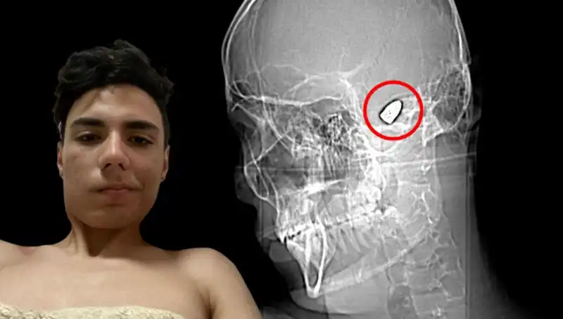 Zihninde Patlayan Bir Bomba: Anksiyete Nedir ve Nasıl Baş Edilir?