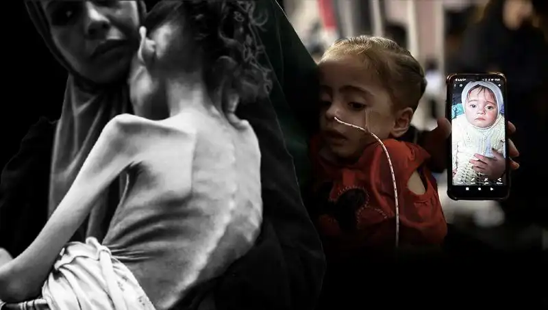 Küçük Meryem’in Açlıkla Mücadelesi: 25 Kilodan 10 Kiloya Düşen Şok Edici Hikaye