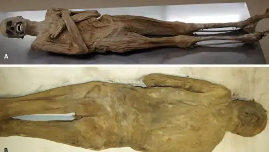 Eski Mısır'a Ait Olmayan Kurutulmuş Papazın Mumyası İle İlgili Şok Edici Gerçekler