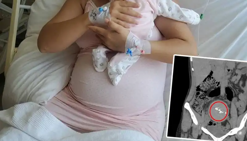 Doğumda Gazlı Bez Unutuldu: İki Yıl Sonra Ortaya Çıkan Skandal